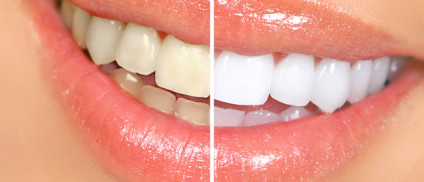 Cosmetic Dentistry